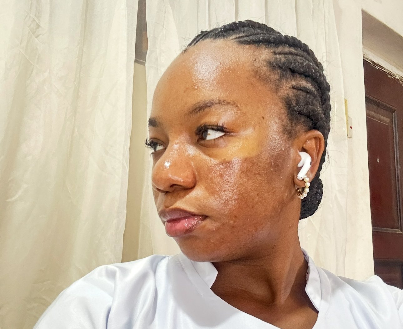 Clinic allegedly vows to jail lady for speaking out after acne treatment results in permanent scar