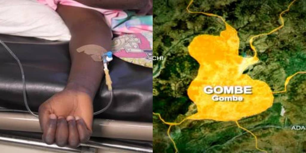 Man lured into tinted car in Gombe after dizziness, escapes from kidney traffickers
