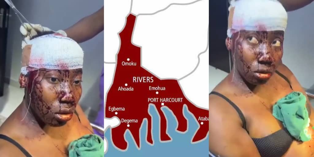 Lady stabbed in the head by fiancé after disagreement in Port Harcourt