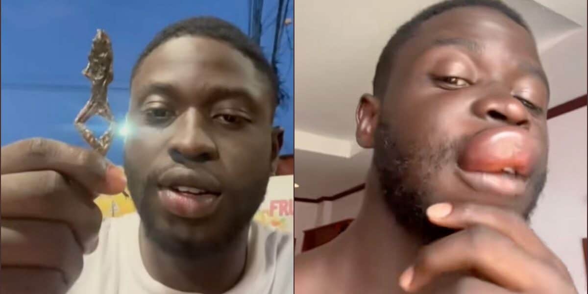 Man suffers allergic reaction after eating roasted frog abroad