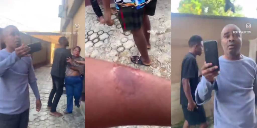 Landlady bites tenant in heated clash