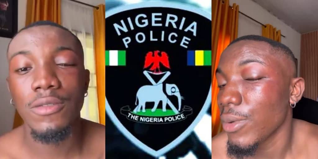 Man cries out after Owerri police drag him to bush in illegal search, extort ₦30,000