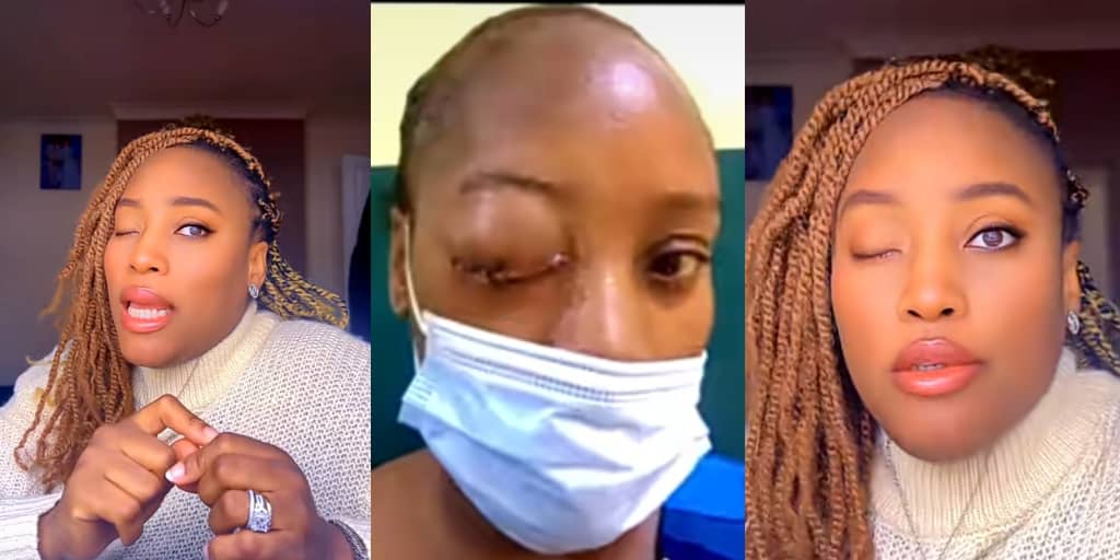 Woman blinded by pregnancy complications, loses baby