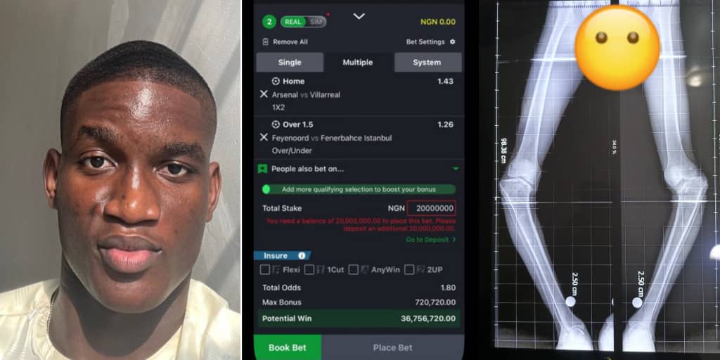 Man advised to stake ₦20 million on sports betting after raising ₦22 million for leg surgery