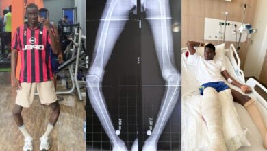 Influencer baddy of lagos undergoes successful first-stage surgery in Egypt