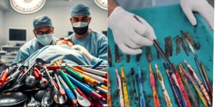 Doctors shocked as they remove 29 spoons and 19 toothbrushes from patient’s stomach