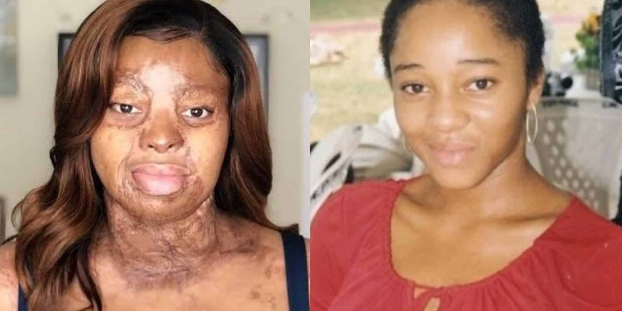 Sosoliso crash survivor Kechi Okwuchi celebrates 36th birthday with gratitude