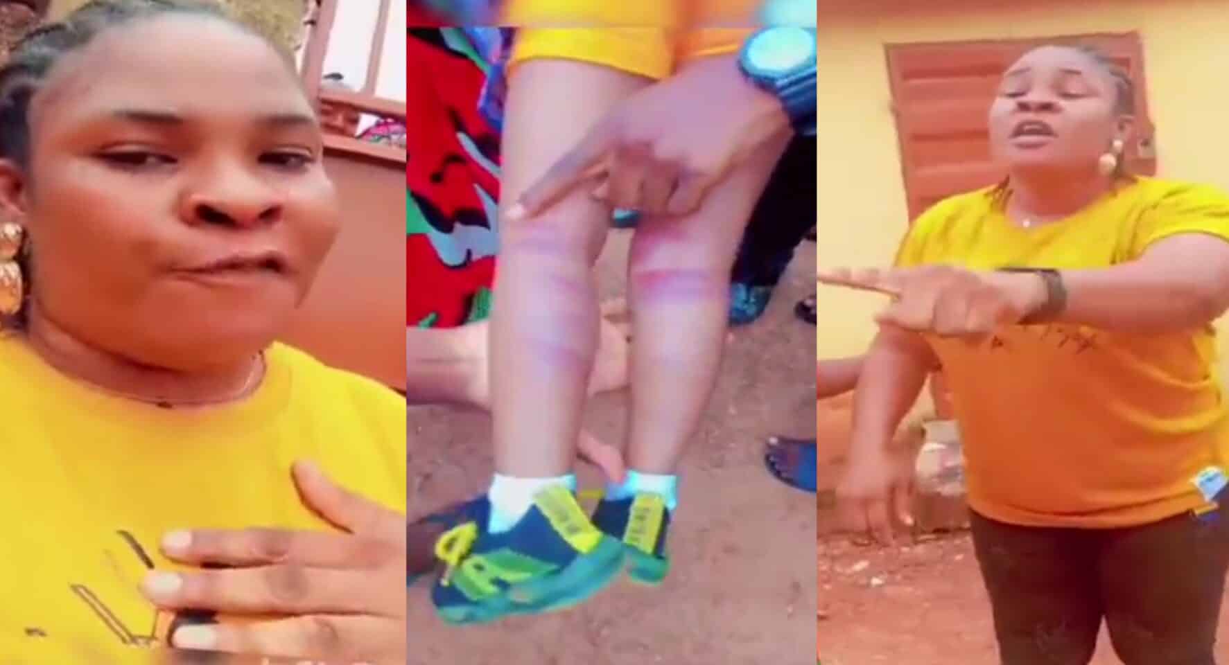 Mother crises out as teacher beats 3-year-old daughter, leaving painful bruises