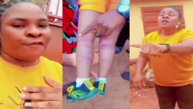 Mother crises out as teacher beats 3-year-old daughter, leaving painful bruises