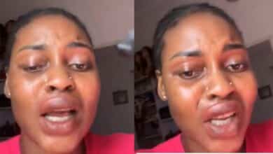 Lady cries out after attraction kayamata lip gloss gives her swollen lips