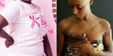 Man divorces wife after she loses both breasts to cancer