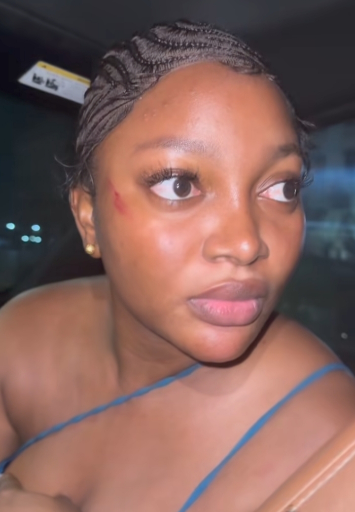 Papaya Ex cries out as she accuses Nigerian Police of assault