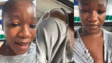 “This feels unreal” – Lady cries out after alleged mad man bites her inside public bus