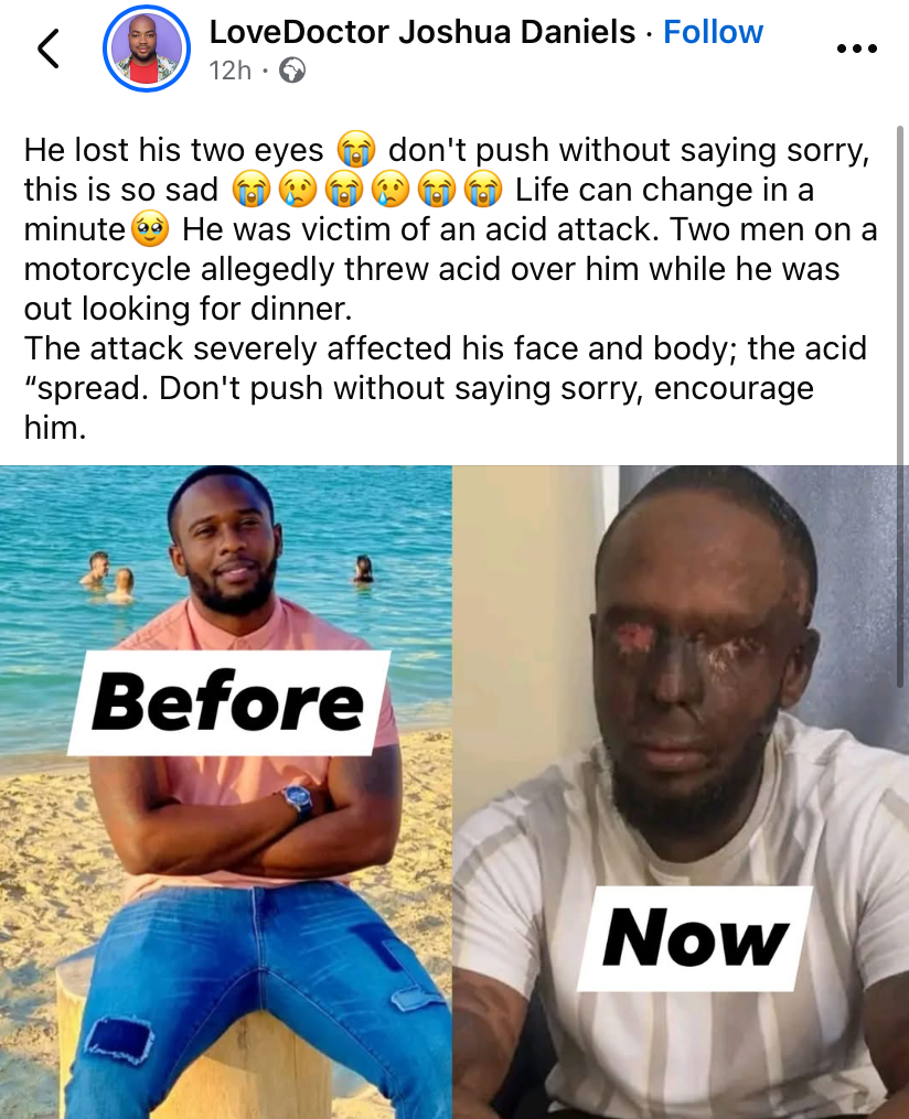 “Life can change in a minute” - Man reportedly loses both eyes after acid attack