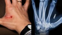 Sweden implants microchips in citizens to replace IDs and credit cards