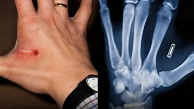 Sweden implants microchips in citizens to replace IDs and credit cards