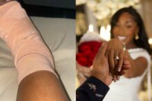 “Marry a kind man o” — Lady recounts husband’s care after gas explosion left her unable to walk