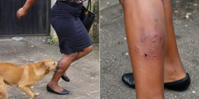 “He told us to sue the dog” - Man cries out after wife was allegedly bitten by neighbour's dog
