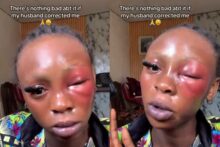 "There's nothing bad about it" — Lady says it's okay for husband to beat her