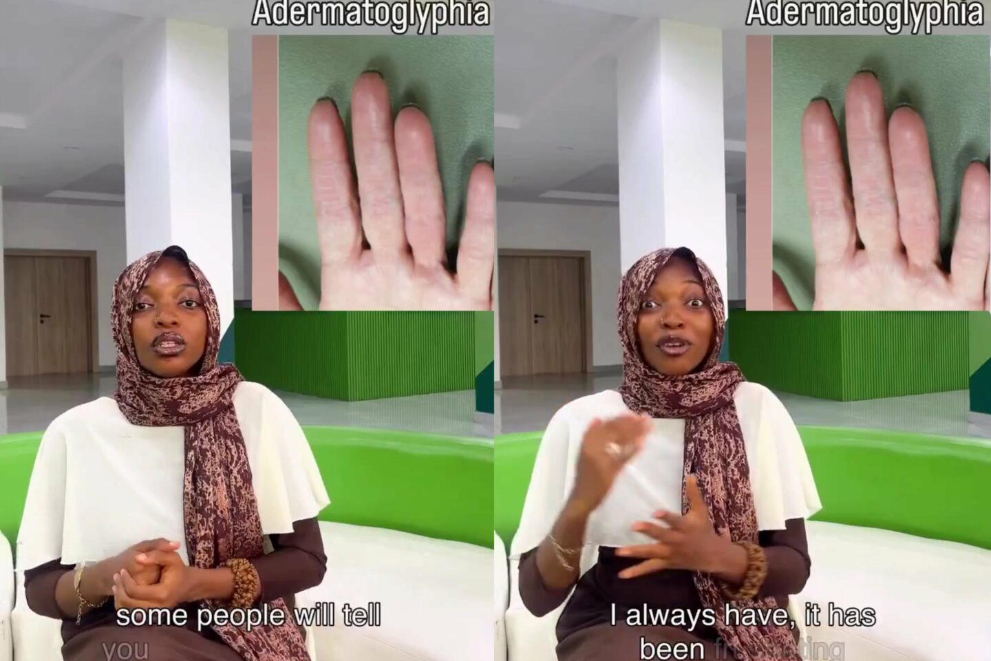 "Living without thumb print in Nigeria is terrible" — Lady recounts struggles with JAMB, NYSC, banks