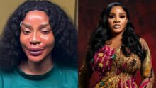 “If you don’t like it, change it” – Uche Ogbodo flaunts new look after cosmetic procedure