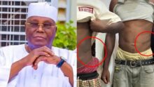 "In Tinubu’s Nigeria, young people are selling their kidneys for ₦1.7m to survive" — Atiku Abubakar