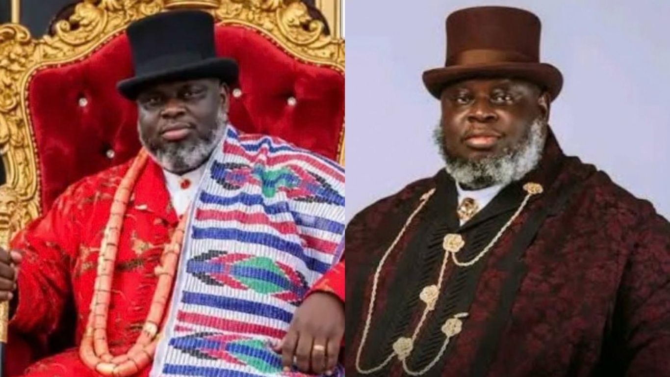 Bayelsa monarch reportedly dies following complications from liposuction surgery